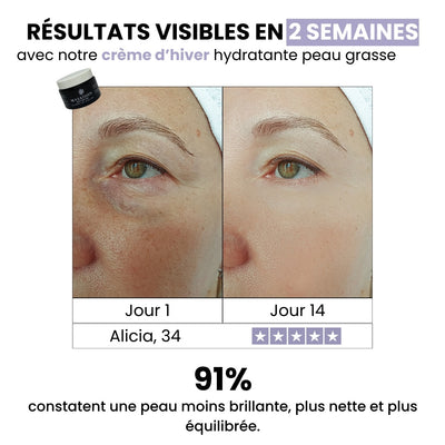 Crème d’hiver hydratante peau grasse