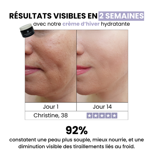 Crème d’hiver hydratante peau sèche