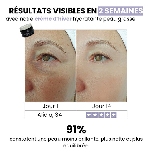 Crème d’hiver hydratante peau grasse